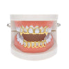 Open Face Gold Grillz