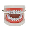 Open Face Gold Grillz